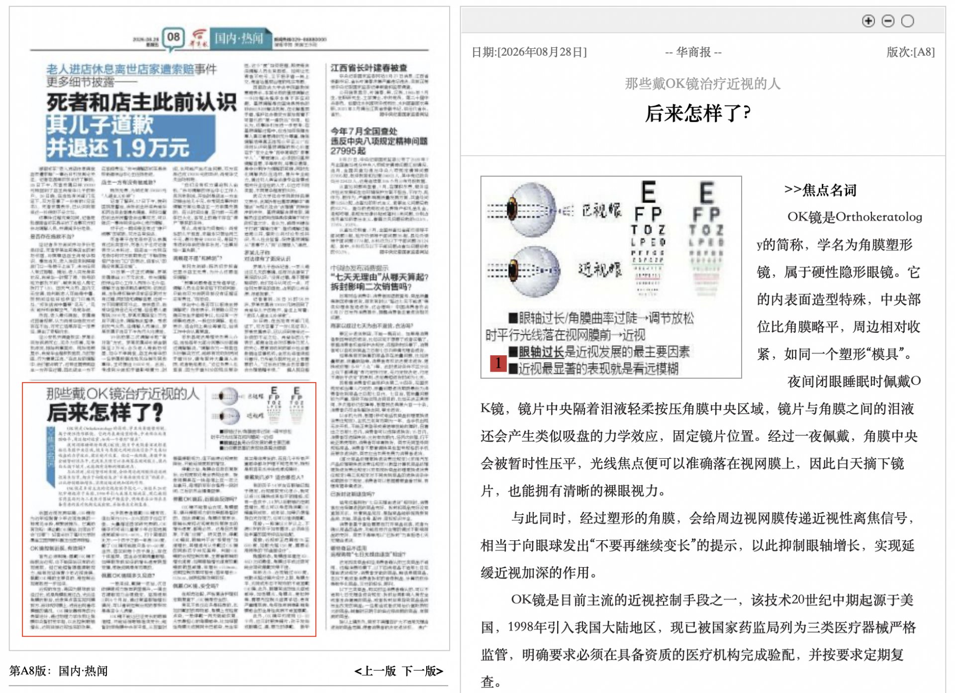 OK镜是Orthokeratolog
